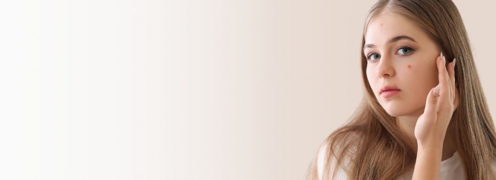 Jak pozbyć się trądziku u nastolatka?