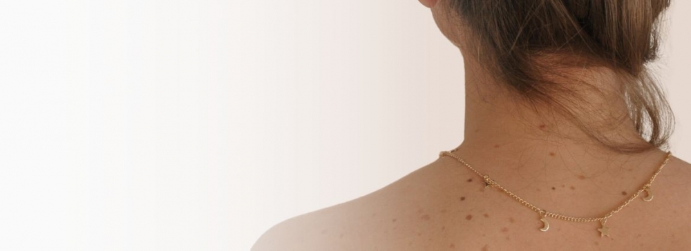 Trądzik na plecach - koniec z tabu! Poznaj skuteczne metody na pryszcze na plecach